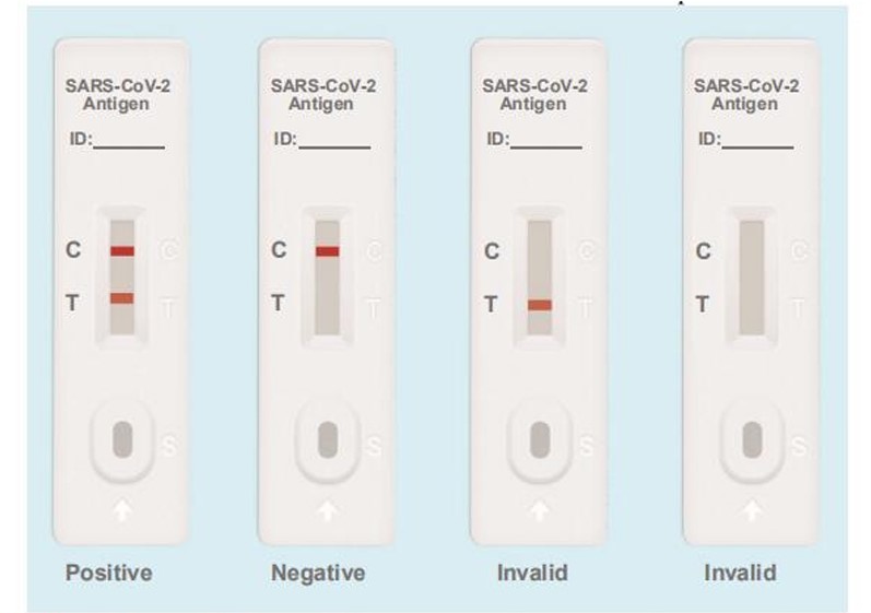 SARS-CoV-2 Antigen Tests Disadvantages