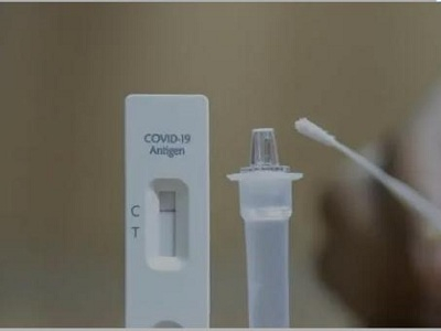 rapid antigen test kit for sale - UDXBIO.jpg